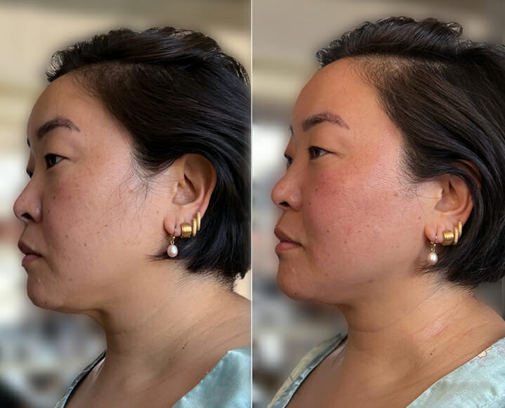 The 6 Ancient Beauty Techniques Behind This Impressive Before + After